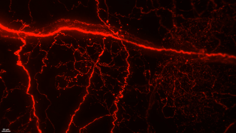 2P light sheet imaging of the atrium in an adult mouse​