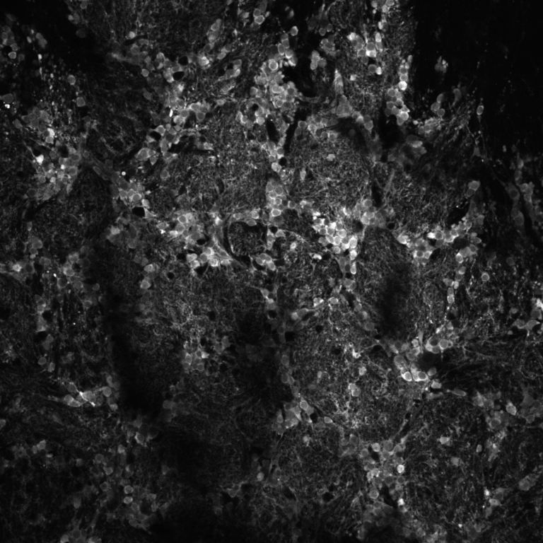 Mouse olfactory bulb with inhibitory cells labelled with GCaMP8s.