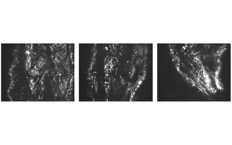 Label-free in vivo widefield SHG imaging of fruit fly larva using PHAROS femtosecond laser.