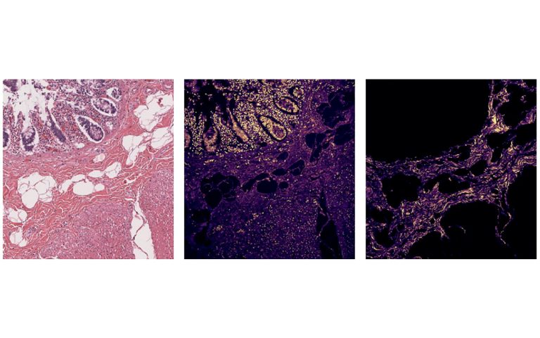 SHG and THG images of H&E-stained colon using FLINT femtosecond oscillator.