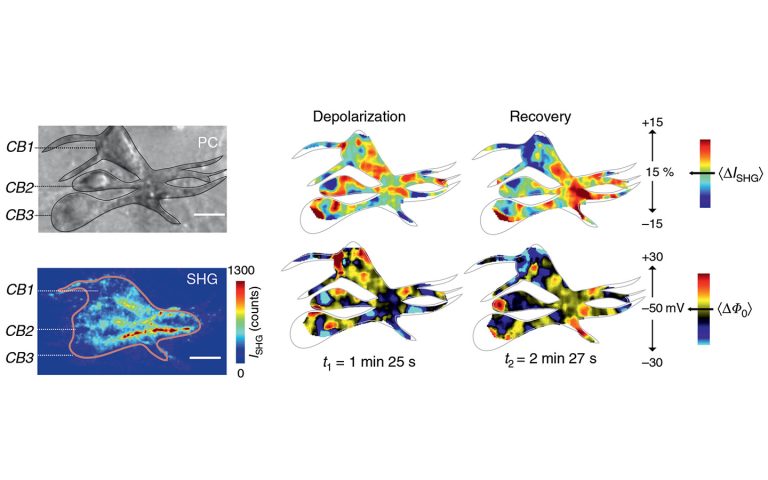 Widefield SHG neuroimaging of neuronal membrane potentials and ion efflux by means of water using PHAROS femtosecond laser.