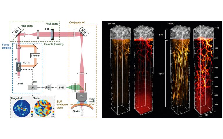 3P microscopy with adaptive optics for focus sensing and shaping to compensate for both aberrations and scattering