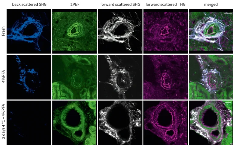 SHG signals from collagen, 2PEF and THG signals from elastin in vibratome sections of mouse kidney after different treatments, using CRONUS-2P femtosecond laser source